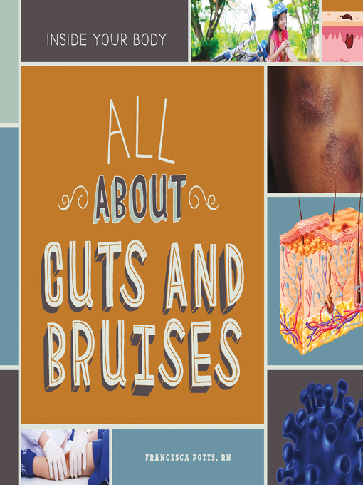 Title details for All About Cuts and Bruises by Francesca Potts, RN - Available